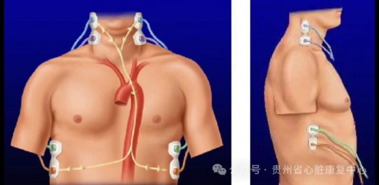 cc8341ff6fb8b4047eff79021362c77f