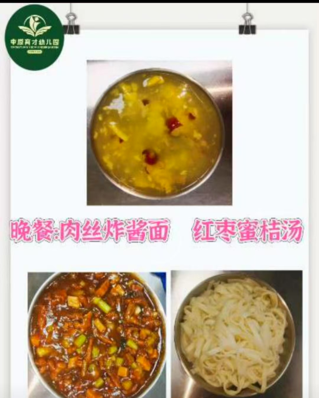 今日晚餐营养：       瘦肉中含蛋白质、钙、铁。       面条中有一定的蛋白质，维生素和矿物质，容易被人体消化和吸收。       蒜苔含有丰富的蛋白质、膳食纤维、维生素、矿物质等。