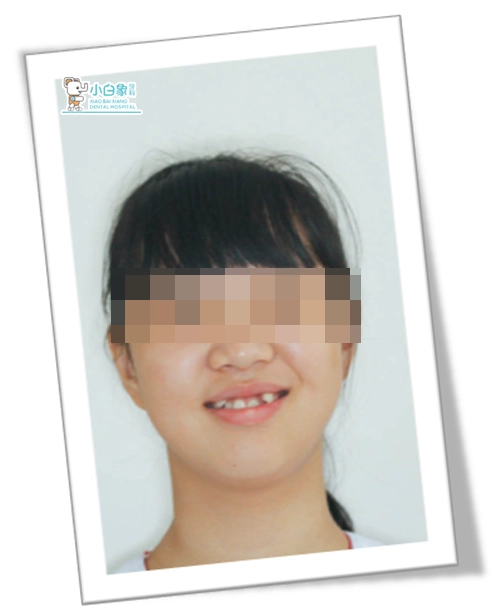 2019-4月种植病例