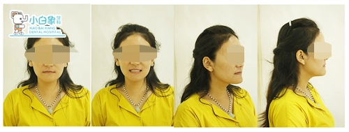 2018-10月正畸病例