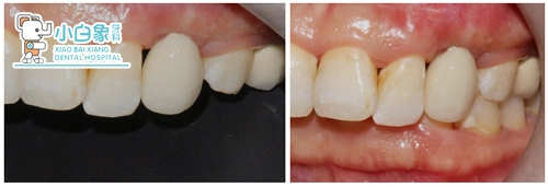 2017-11月种植病例