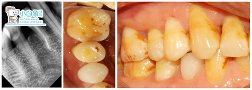 2019-10月修复病例