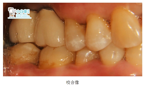 2019-3月种植病例