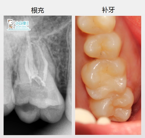 2019-1月补牙病例