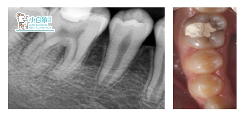 2019-4月修复病例