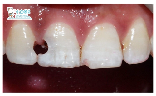 2019-2月份修复病例
