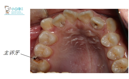 2019-5月修复病例