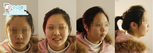 2018-5月正畸病例