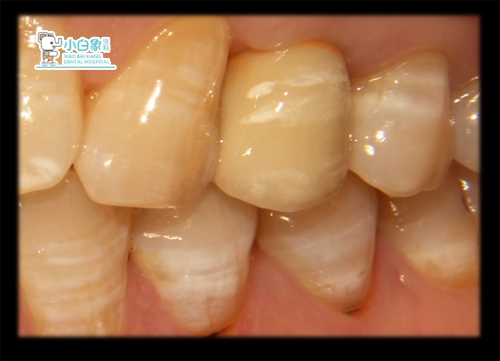 2019-11-种植病例