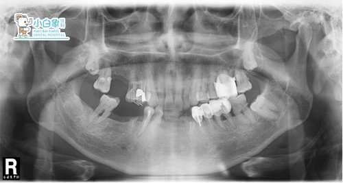 2019-09-种植病例
