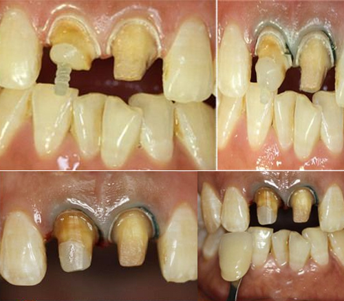 2025-9月修复病例展示