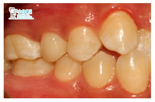 2018-11月修复病例