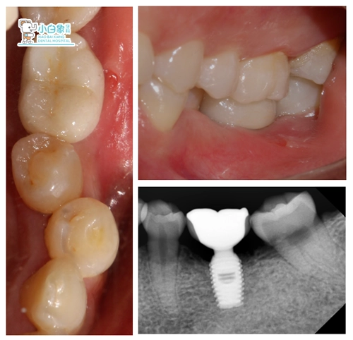 2018-2月种植病例