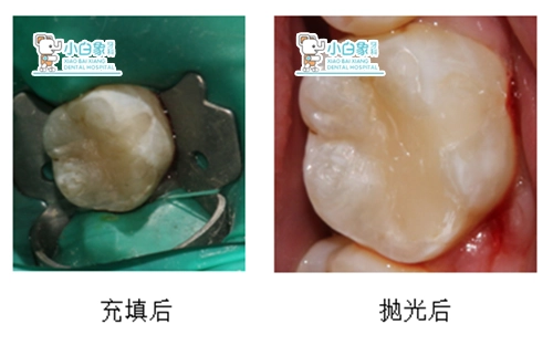 2019-5月修复病例