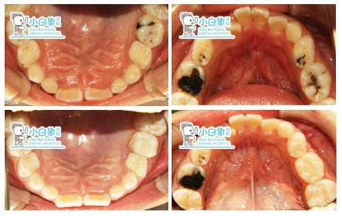 2019-11月儿牙病例