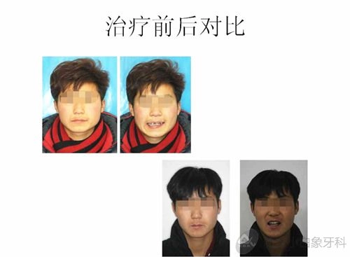 2015-02-一月份正畸病例展示