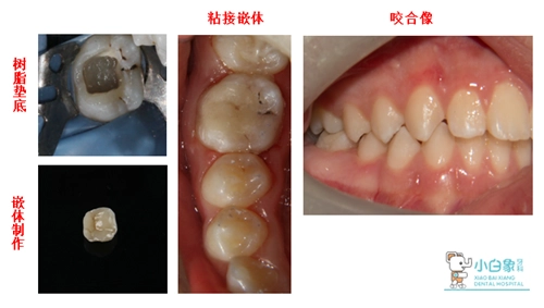 2019-3月修复病例