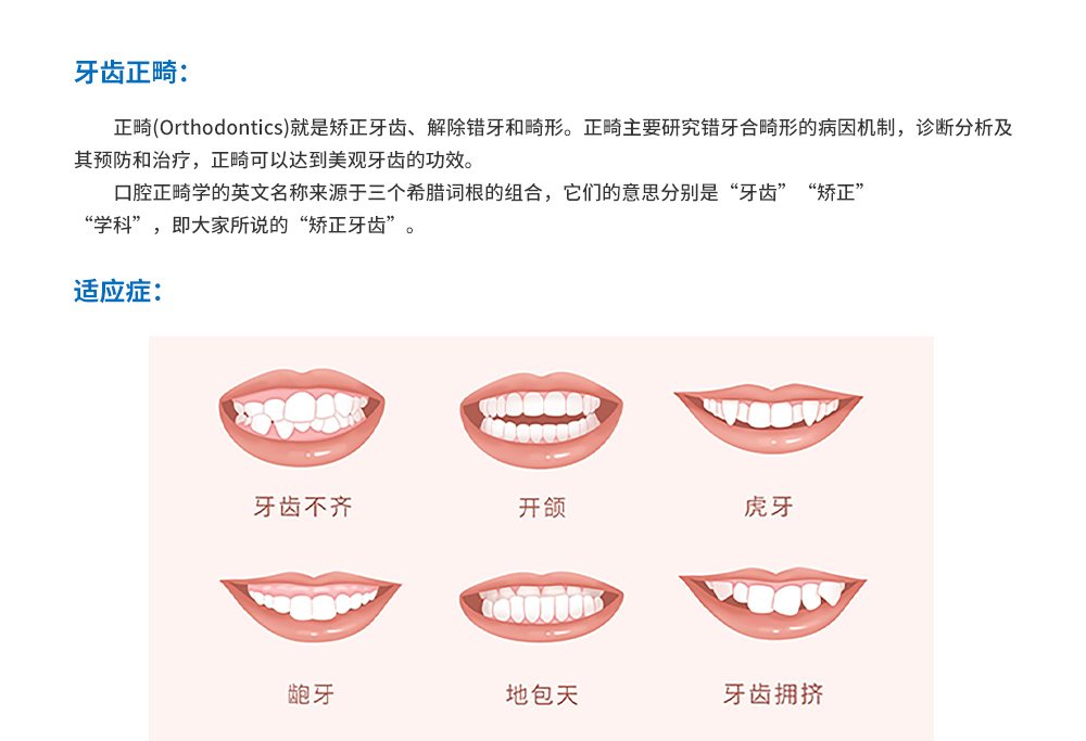 牙齿正畸1