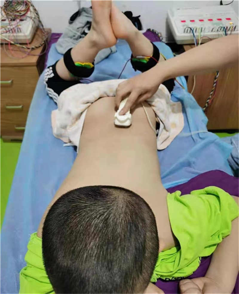 22 孩子做理疗